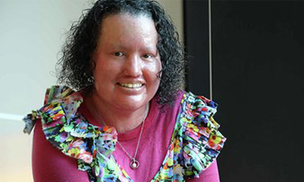Photo of Carly Findlay